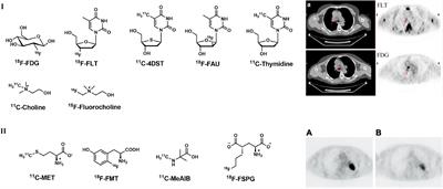 Positron emission tomography imaging of lung cancer: An overview of alternative positron emission tomography tracers beyond F18 fluorodeoxyglucose